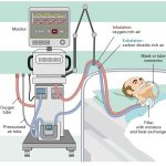 آشنایی با دستگاه‌های رایج در ICU: ونتیلاتور، مانیتور، پمپ سرم و دیگر تجهیزات حیاتی