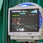 نقش هوش مصنوعی در ICU در منزل: تحولی در بیمارستان مجازی
